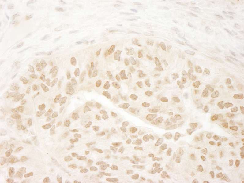 DOT1L / DOT1 Antibody (aa1000-1050)