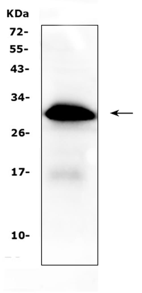 Polyclonal Rabbit anti-Human IGFBP1 Antibody (IHC, WB)