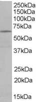 IHC-plus™ EHD2 Antibody (aa529-542)