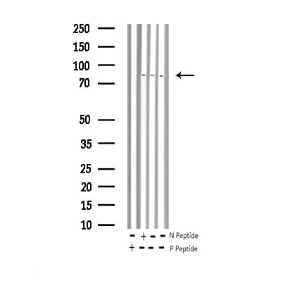 Polyclonal Rabbit anti-Human HSF1 Antibody (phospho-Ser303, IHC, IF, WB)