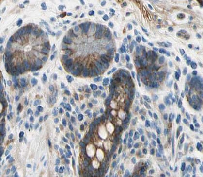TNFSF13 / APRIL Antibody