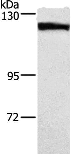 DSG1 / Desmoglein 1 Antibody