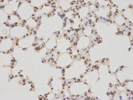 Polyclonal Rabbit anti-Human TMPO / TP / Thymopoietin Antibody (IHC, IF, WB)