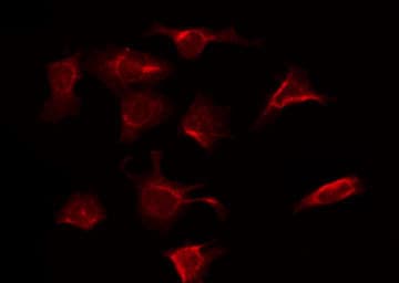 RAF1 / RAF Antibody (phospho-Ser301)