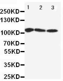 ATP2A1 / SERCA1 Antibody (aa665-680)