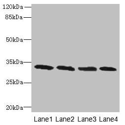 Polyclonal Rabbit anti-Human PNP / Nucleoside Phosphorylase Antibody (aa1-289, WB)