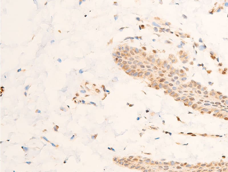 SGK1 / SGK Antibody (phospho-Ser422)