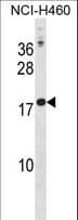 Placental Lactogen Antibody (aa42-70)