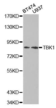 Polyclonal Rabbit anti-Human NAK / TBK1 Antibody (IHC, WB)