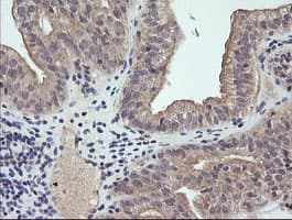 RAB21 Antibody (clone OTI6E12)
