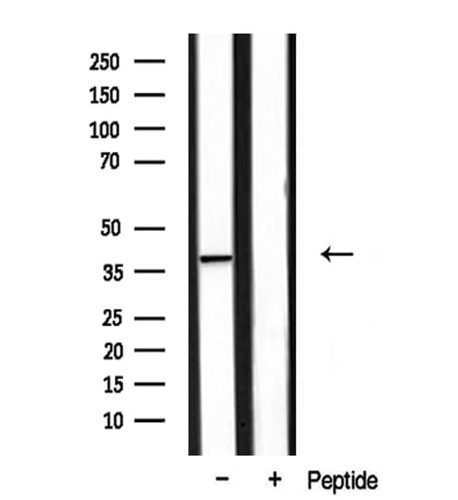 Polyclonal Rabbit anti-Human DOK4 Antibody (IF, WB)