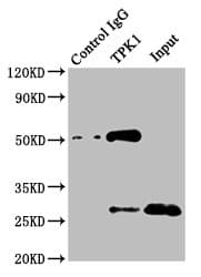 Polyclonal Rabbit anti-Human TPK1 Antibody (IHC, IF, WB)