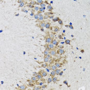 CDK1 / CDC2 Antibody