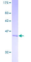 Human ARL6 Protein (Recombinant GST)