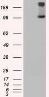 TRPM4 Antibody (clone OTI14C3)
