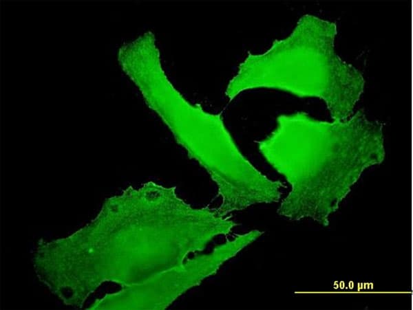 Monoclonal Mouse anti-Human Band 4.1 / EPB41 Antibody (clone 3D9, IF, WB)