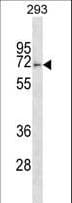 FBXO46 Antibody (aa584-612)