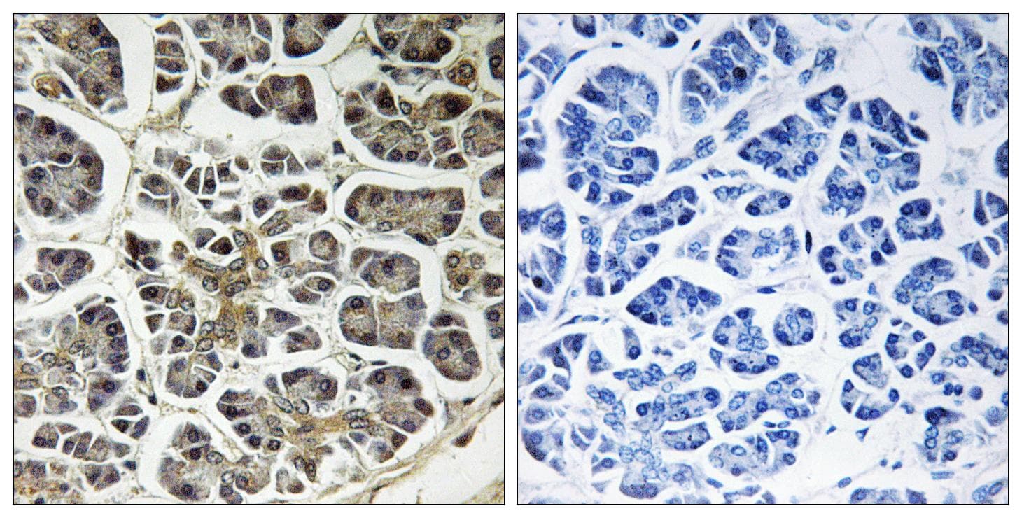 ATP5G2 Antibody