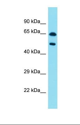 Polyclonal Rabbit anti-Human PAX8 Antibody (aa279-328, WB)