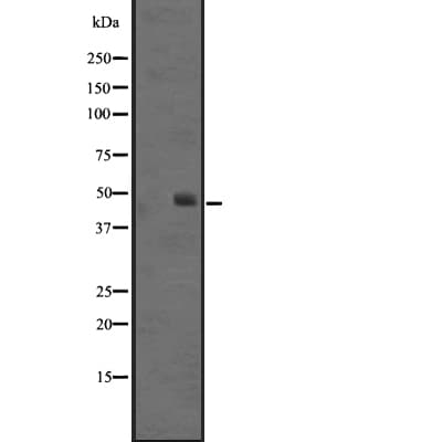 Polyclonal Rabbit anti-Human SSTR4 Antibody (IHC, WB)