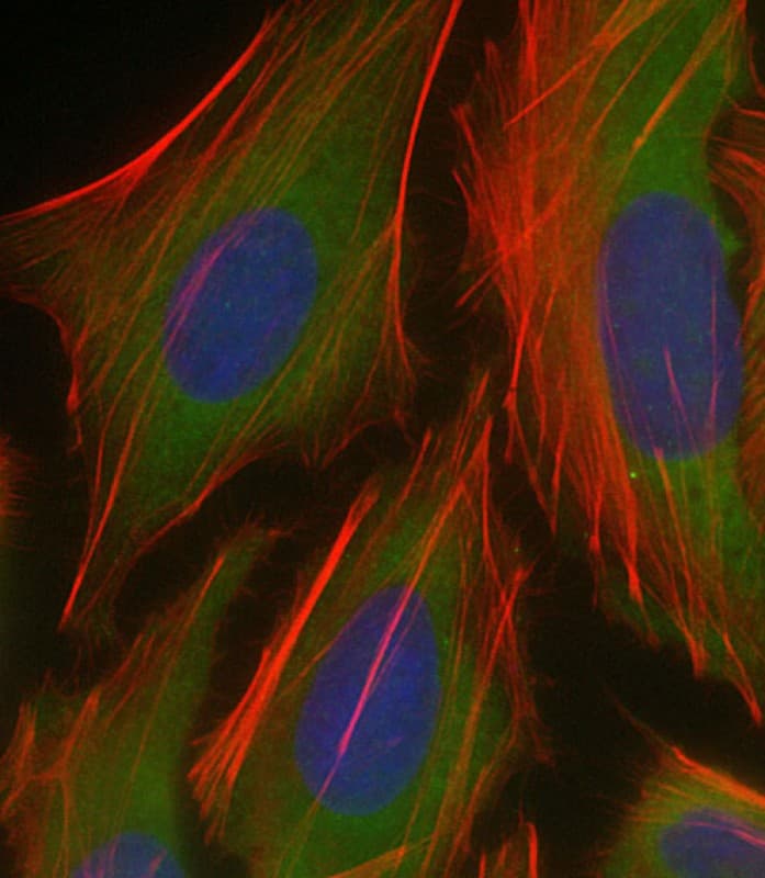 Polyclonal Rabbit anti-Human PKN1 Antibody (C-Terminus, IHC, IF, WB)