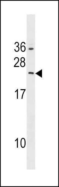 RAB5B Antibody (aa85-112)