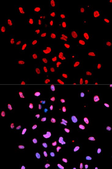 BTK Antibody (phospho-Tyr223)