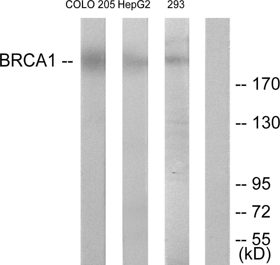 BRCA1 Antibody (p1524)