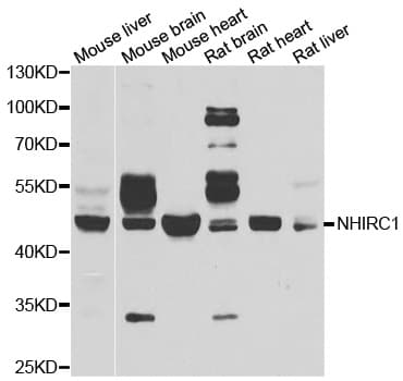 Polyclonal Rabbit anti-Human MALIN / NHLRC1 Antibody (IHC, IF, WB)