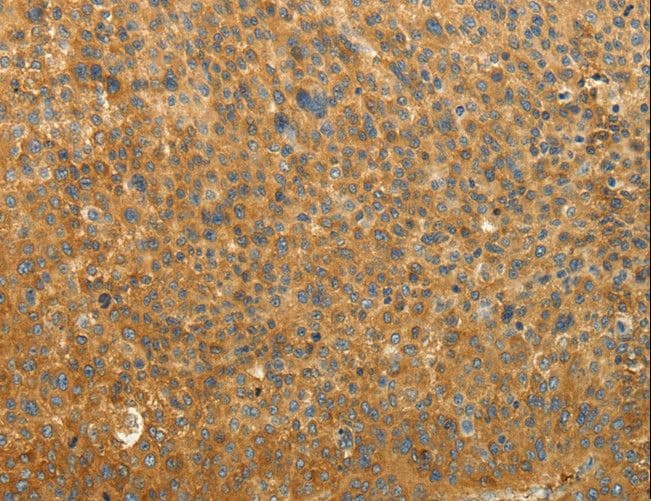RAB35 Antibody