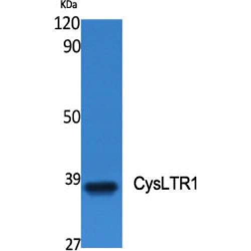 Polyclonal Rabbit anti-Human CYSLTR1 / CYSLT1 Antibody (100-180 aa, Internal, IF, WB)
