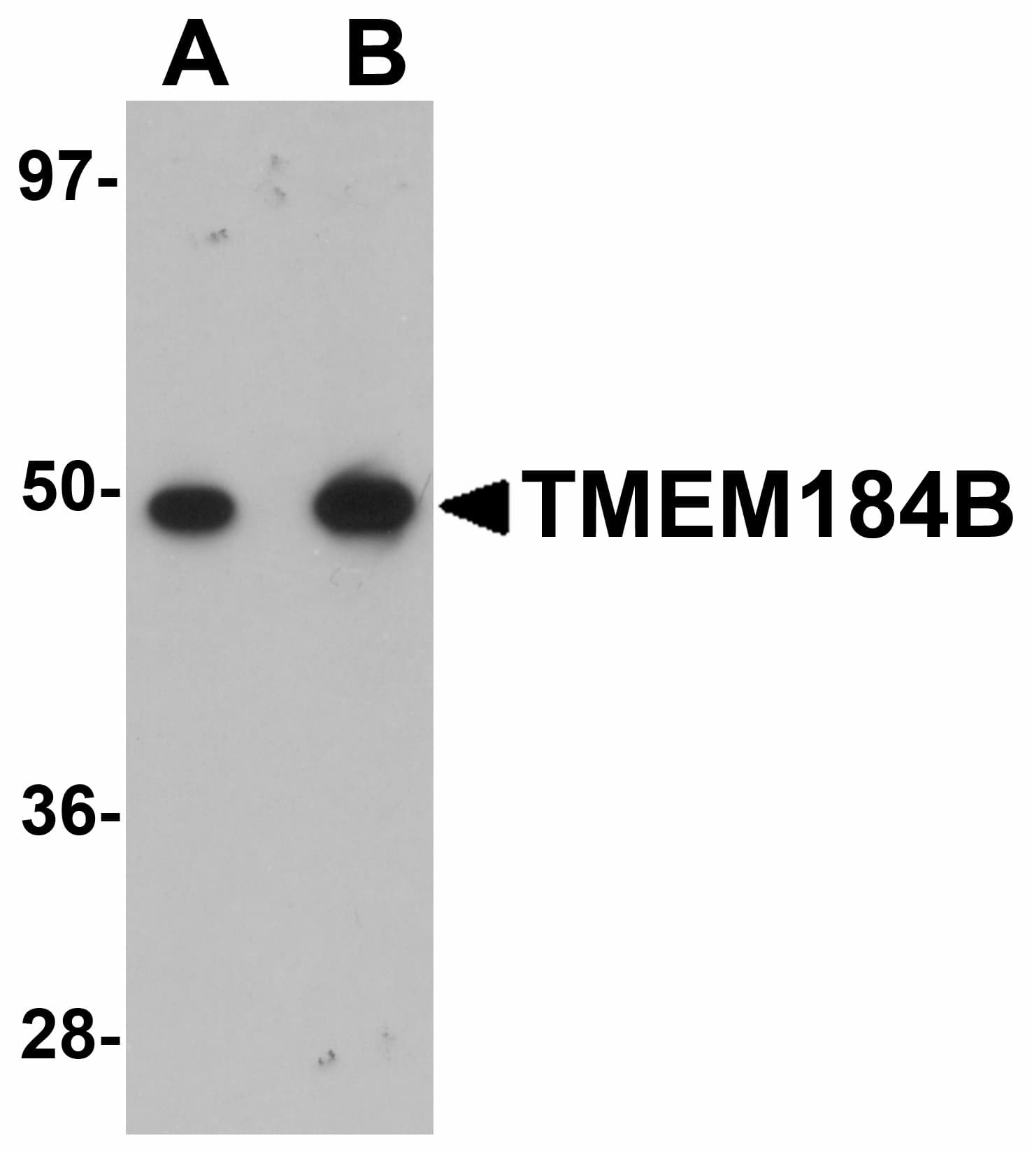 IHC-plus™ TMEM184B Antibody