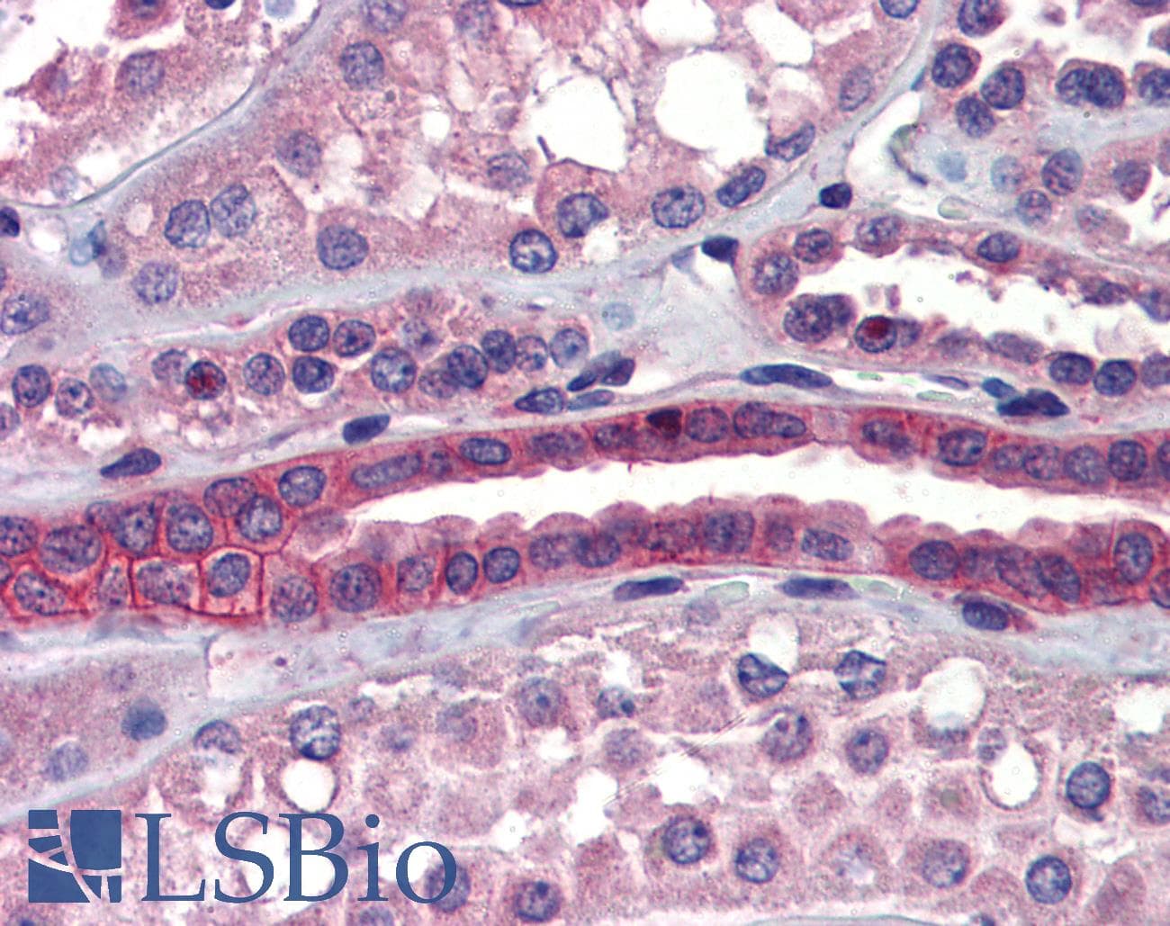 Polyclonal Rabbit anti-Human SSX2IP Antibody (aa362-411, IHC, WB)