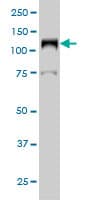IHC-plus™ LIG1 / DNA Ligase 1 Antibody (clone 10G12)