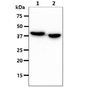 ACAA1 Antibody (clone AT9E5)