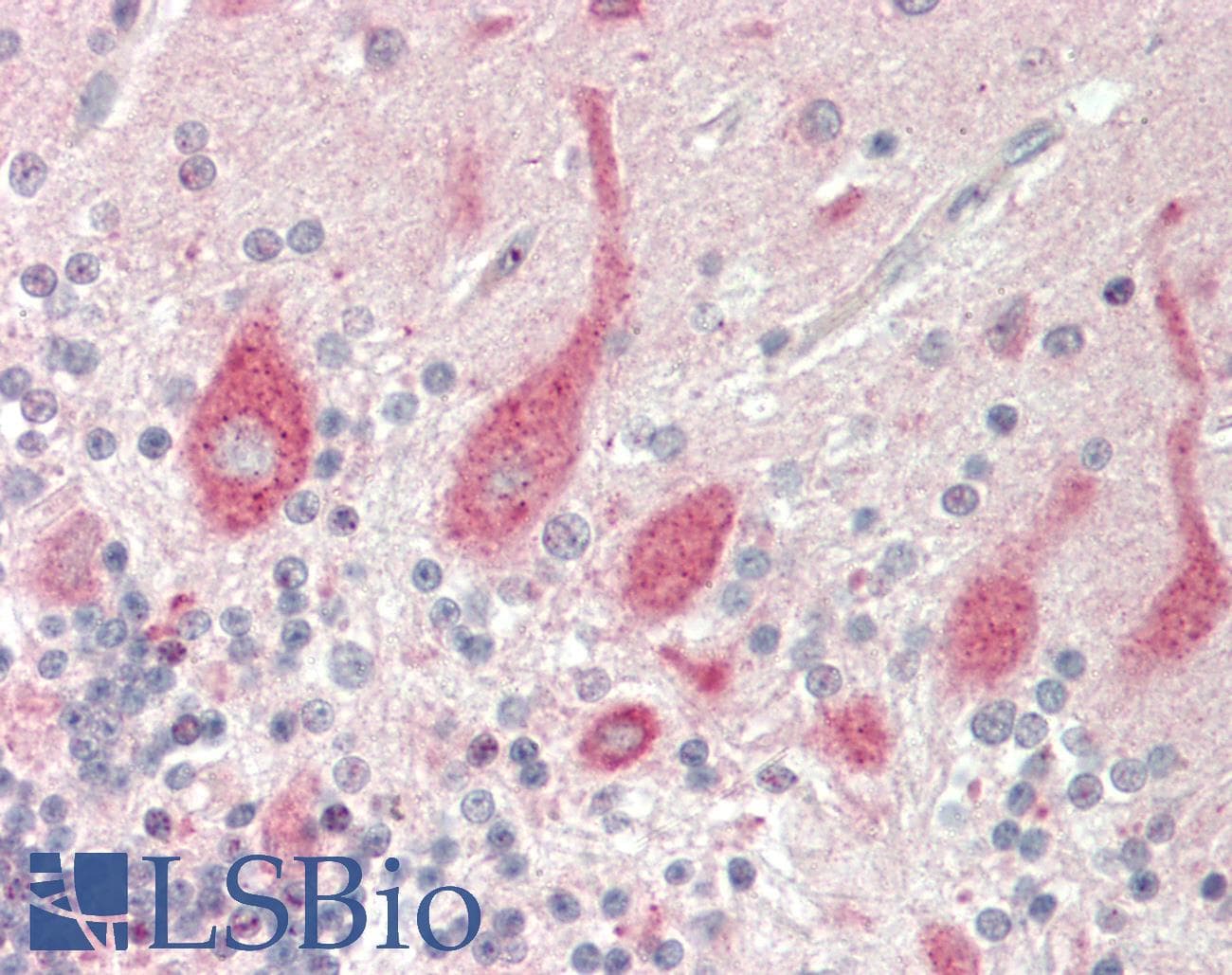 IHC-plus™ GNAL Antibody (aa50-100)