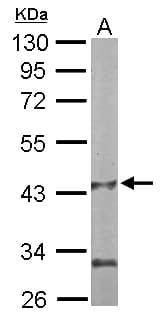 Polyclonal Rabbit anti-Human PANK1 / PANK Antibody (aa207-513, IHC, WB)