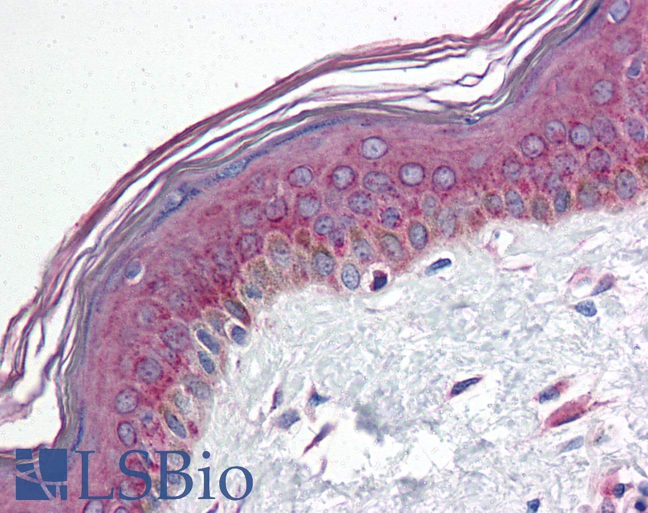 IHC-plus™ HIF1A / HIF1 Alpha Antibody (aa432-528)