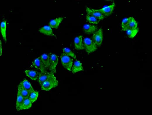 Polyclonal Rabbit anti-Human SULF2 / Sulfatase 2 Antibody (IHC, IF, WB)