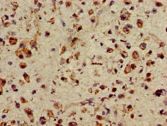 ASH1L / ASH1 Antibody