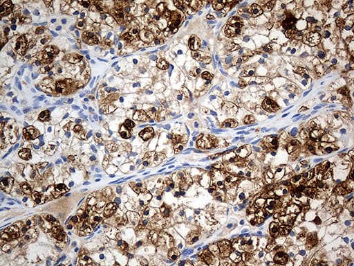 PTPN22 / PEP Antibody (aa359-449, clone OTI6B1)