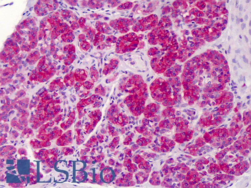 IHC-plus™ FANCC Antibody (C-Terminus, Preservative Free)