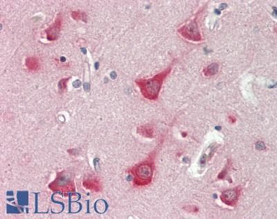 Polyclonal Rabbit anti-Human TUB / Tubby Antibody (N-Terminus, IHC, WB)