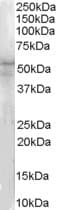 IHC-plus™ IRAK4 / IRAK-4 Antibody (aa2-13)
