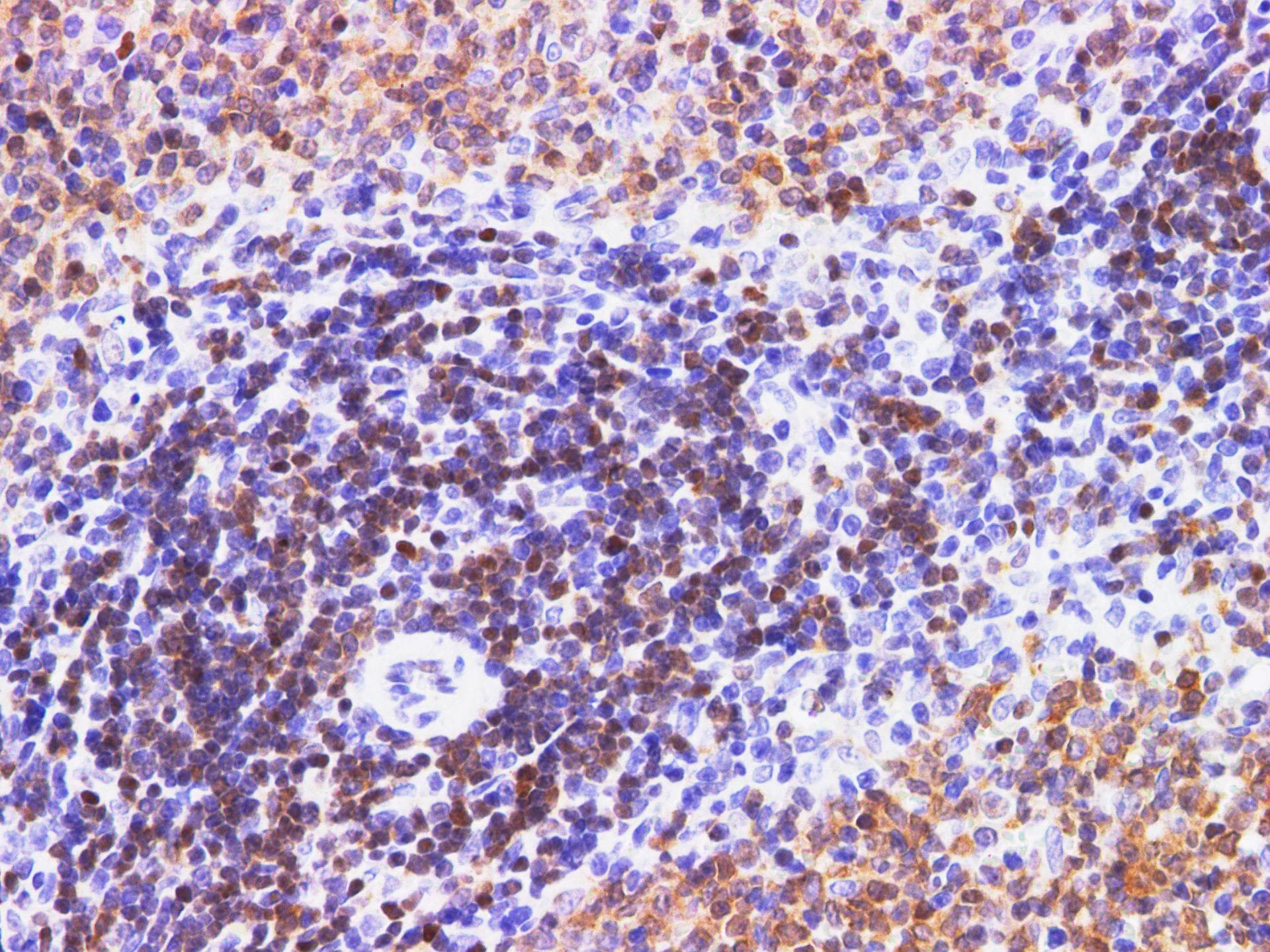 Polyclonal Rabbit anti-Human PDCD4 Antibody (IHC, WB)