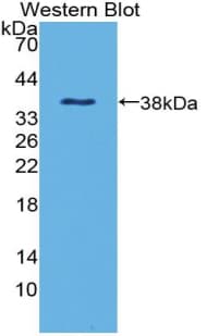 DEFB1 / BD-1 Antibody (aa22-68)