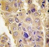 Apg7 / ATG7 Antibody (aa540-569)