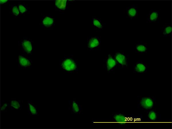 AKT1 Antibody (clone 2E11)
