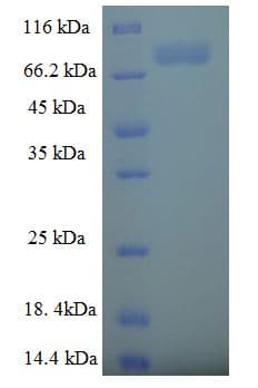 Human SPRING / TRIM9 Protein (Recombinant His-SUMO)