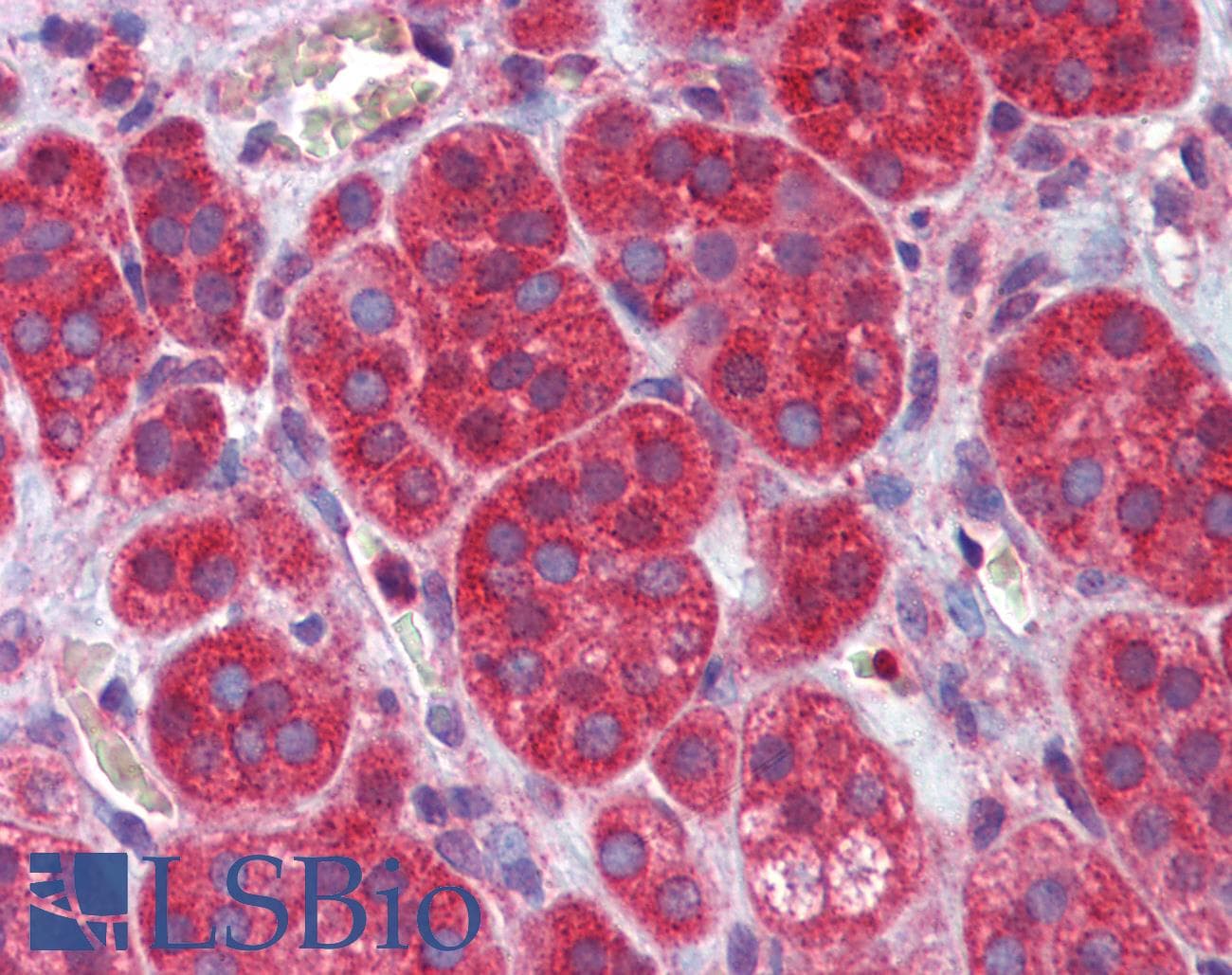 IHC-plus™ Polyclonal Rabbit anti-Human MEF2C Antibody (Ser59, IHC, WB)